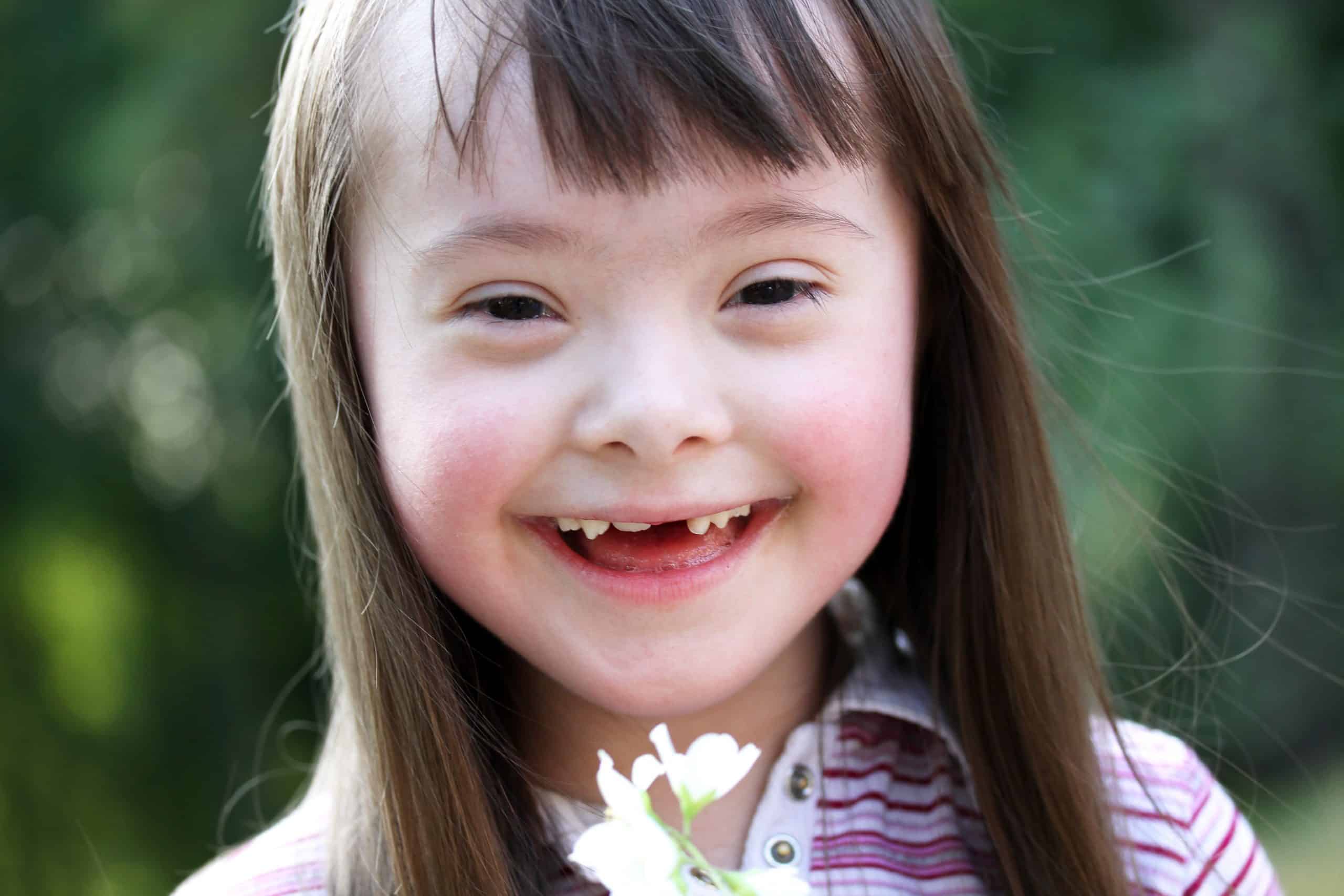 girl child with down syndrome